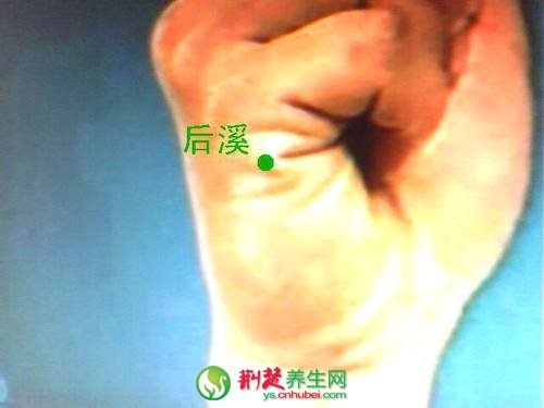 艾灸美容 艾灸后溪穴治麥粒腫