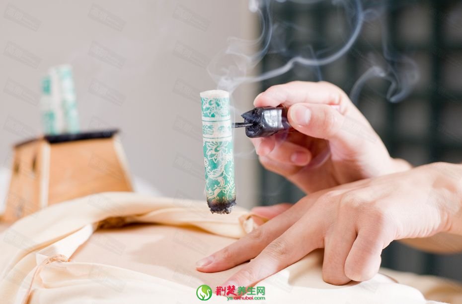 艾灸的簡介及注意事項