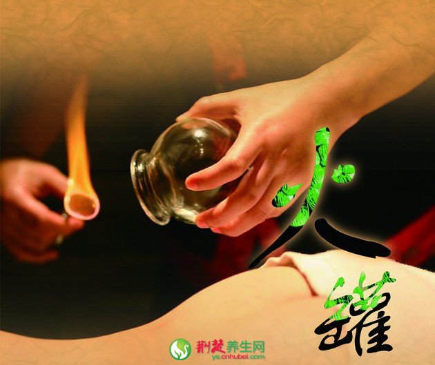 養(yǎng)生火罐 讓你一年少生病