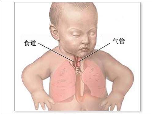 圖片[1]-秋季食道癌易高發 白領如何防治食道癌-起舞食譜網